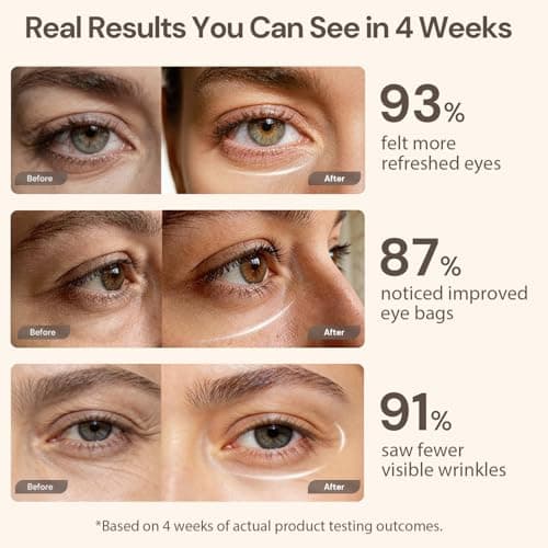 Red Light Therapy for Eyes, Under Eye Red Light Eye Mask for Fine Lines Eye Bags, 3 Modes Face Mask Device, Infrared Light Therapy for Dark Circles, Visual Wellness, Eye Fatigue, Jet Lag - Thumbnail 4