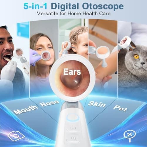 Aspoven Otoscope Ear Camera with Light, 1.4” Screen 1080P HD Ear Scope, 12 Silicone Specula Tips, Photo & Video Recording, Type-C Rechargeable, Ear Cleaning Camera for Adult Kid and Pet - Thumbnail 3