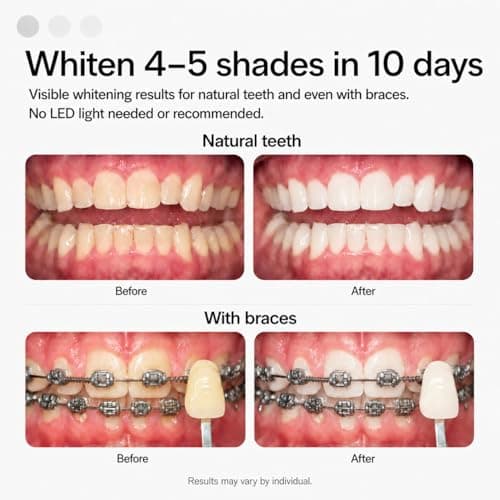 Opalescence GO 15 Whitening Bundle - (7 Treatments) Hydrogen Peroxide Prefilled Teeth Whitening Trays and Travel Sensitive Whitening Toothpaste 1 Oz - Mint Flavor- Includes a Toothbrush - 6288-1T - Thumbnail 4