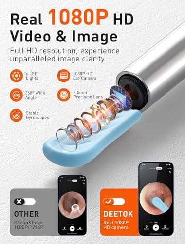 DEETOK Ear Wax Removal Tool Camera - Ear Cleaner with 1080P HD Camera, FSA HSA Store Eligible, Otoscope with Light, Earwax Removal Kit with 50 Replacement Tips for iPhone, iPad, Android Phones (Black) - Thumbnail 2