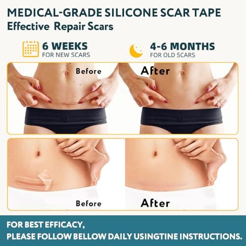 Silicone Scar Tape - 60" x 1.6" Roll - 1.5M, Scar Treatment for Improves Surgical, Keloid, Hypertrophic Scars - Medical Grade Reusable Silicone Scar Sheets - Thumbnail 3