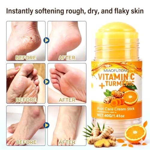 Imcamity Electric Foot Callus Remover Rechargeable Foot File for Dead Skin - Thumbnail 2