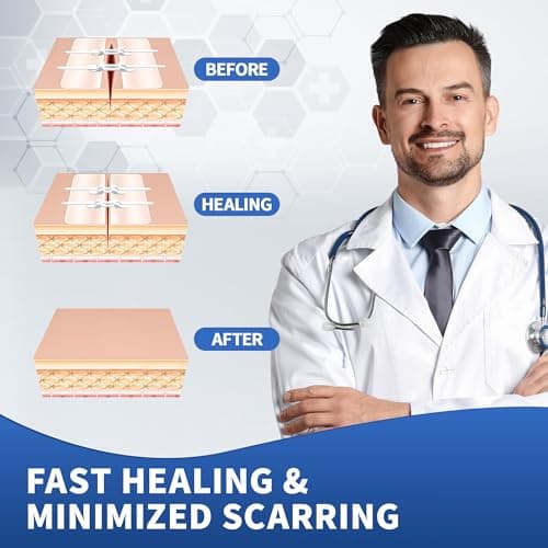 RYNORA 6 Pack Wound Closure Strips Butterfly Bandages(0.8"x 3"),Repair Wounds Without Stitches, Quick Clot Zip Stitch Wound Closures Device for First Aid Kits, Outdoor Activities, and Home Use - Thumbnail 5