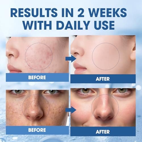 Salmon DNA PDRN Peptide Serum – Hydrating, Firming & Brightening, Uneven Skin Tone, 1.01 fl.oz. - Thumbnail 3