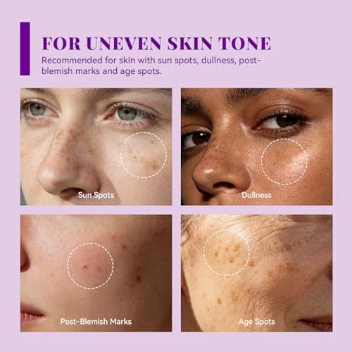 ANAI RUI Tranexamic Acid Cream with 70,000ppm Arbutin & 50,000ppm TXA, 5% Niacinamide, Dark Spot Care, Smooth & Even-Looking Skin, 1.7oz - Thumbnail 4