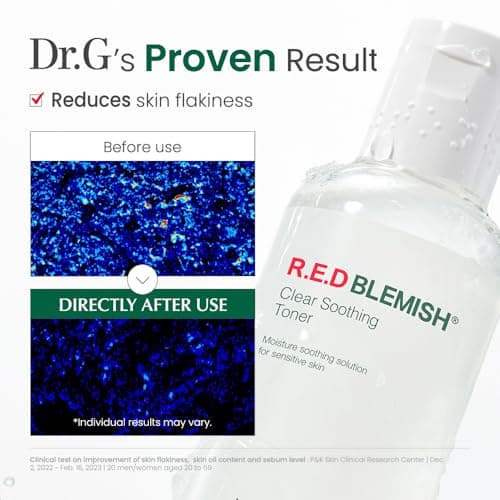 Dr. G R.E.D. Blemish Clear Soothing Toner - Korean Soothing Toner for Glowing Skin - Soothes Irritation Clear Skin - Mild Exfoliant - with AHA, BHA & Centella Asiatica - 10.14 fl oz - Thumbnail 6