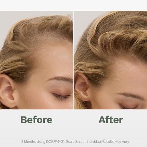 DORPANG Scalp Serum for Thinning Hair, Clinically Tested Formula with Peptides & Rosemary Oil, Non-Greasy No-Rinse Scalp Care for Men & Women, 60ml - Thumbnail 3