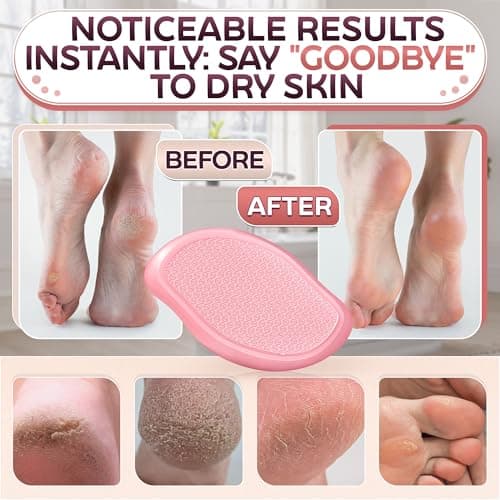 Nano Glass Foot File – 4.6" Glass Foot Callus Remover, Ergonomic Heel Scraper for Cracked Heels, Scratch-Resistant & Non-Wearing – Moisture-Resistant & Gentle Cleansing, Designed for Wet or Dry Use - Thumbnail 6