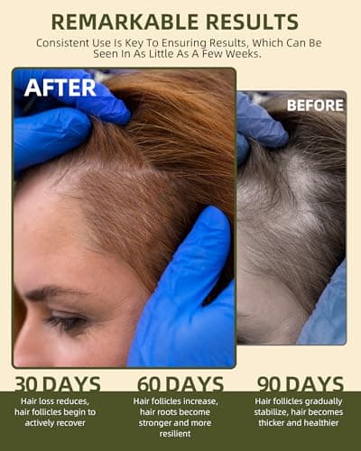 Ktintar 100% Natural Raw Batana Oil for Hair Growth, Dr Sebi Hair Growth Oil From Honduras, Thicker & Stronger Hair, Prevents Hair Loss, Eliminates Split Ends 4.23 Fl Oz (Pack of 1) - Thumbnail 3