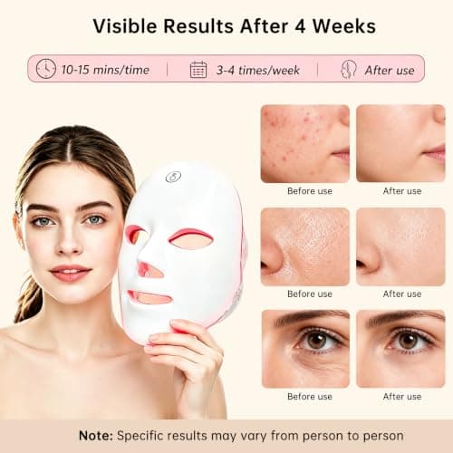 xiongliehuo Red Light Therapy for Face, 7 Color Red Light Facial Masks, At-Home Facial Care Device, Portable, Cordless, and Rechargeable - Thumbnail 3