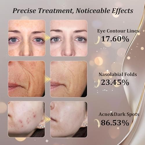 CUEME Red Light Therapy for Face, FDA-Cleared LED Light Therapy Mask for Wrinkles, Acne Treatment, and Skin Care, Portable Facial Mask for Women - Mom, Sister, Girlfriend, and Wife - Thumbnail 4