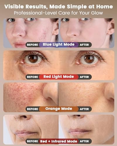 Red Light Therapy for Face Wireless with 400 Leds, 360° Led Face Mask Light Therapy with 4 Modes & Near-Infrared, 2000mAh Rechargeable Led Face Mask with Eye Protection for Anti-Aging & Radiant Glow - Thumbnail 6