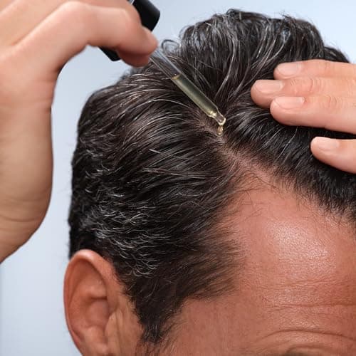 Caldera + Lab The Hair Serum | Men’s Thickening Serum for Thinning & Receding Hair, Supports Fuller & Stronger-Looking Hair, Dermatologically Tested - All Hair Types - Thumbnail 5