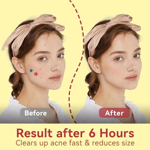 OMADOTO Star Pimple Patches for Face - 6 Colors 198Pcs (14mm) Hydrocolloid Acne Patches, Day & Night Blemish/Zit Healing Pimple Patches (66count-Pack of 3) - Thumbnail 3