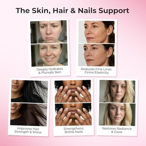 OxyEnergy Collagen Peptides Capsules for Women, Hydrolyzed Collagen Supplements with Elastin Peptides, 60 Collagen Pills to Promotes Hair, Nail, Skin, Capsulas - Thumbnail 2