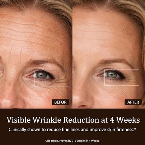 SUBRUN Red Light Therapy for Face, FDA-Cleared Red Light Therapy Mask, 336 LEDs Full Face Coverage & 4 Modes, Rechargeable Cordless At-Home Facial Skincare Device, Birthday Gifts for Women Mom Wife - Thumbnail 3