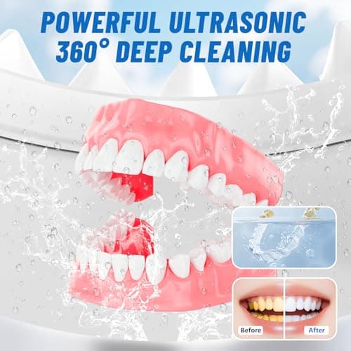 Ultrasonic Retainer Cleaner Machine for Dentures | 45kHz Dental Cleaning Pod for Aligner, Nightguard, Braces, Jewelry, Watch, 3 Timer Modes - with Cooling Fan & Removable Base Moonlight White - Thumbnail 4