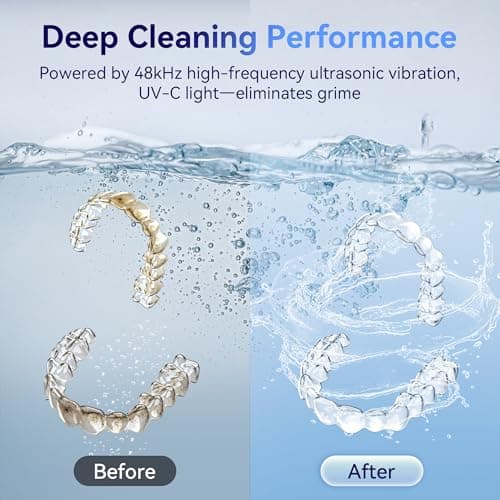 UMPOPO Ultrasonic Retainer Cleaner Machine 48kHz, Dental Cleaning Pod, Ultrasonic Retainer Cleaner for Dentures, Aligners, Mouth Guards, Toothbrush Heads and Jewelry with 200ML Capacity, LAB Supply - Thumbnail 5