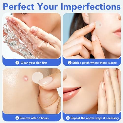 Pimple Patches for Face,Acne Patches for Face,Pimple Patch,Zit Patches,Hydrocolloid Blemish Patches for Covering Zits ,with Salicylic Acid,Tea Tree oil & Calendula oil (106 Counts, Count, 106.0) - Thumbnail 6