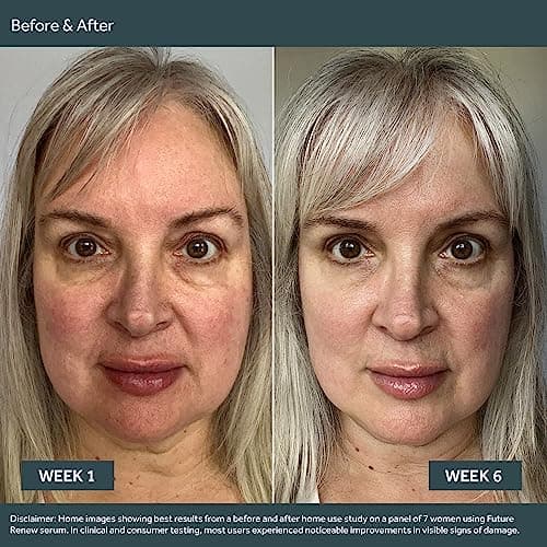 No7 Future Renew Damage Reversal Anti Aging Serum for Face - Face Serum for Women with Peptides to Support Skin Repair - Helps Reduce Fine Lines, Wrinkles, Dryness & Uneven Tone (0.84 Fl oz) - Thumbnail 5