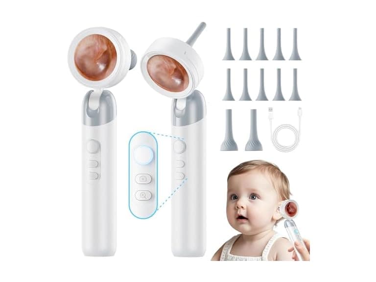 ASPOVEN 1080P HD Otoscope Ear Camera - Image 1